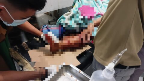 Korban serangan buaya di Desa Iyok mendapat perawatan medis di Puskesmas Nuangan sebelum dirujuk ke rumah sakit untuk penanganan lanjutan